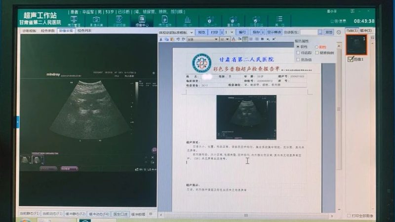 体检项目规格参数主要包括以下几方面：